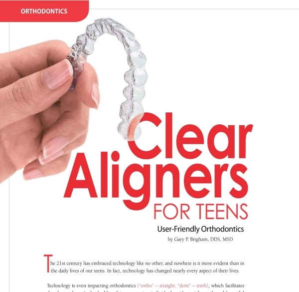 Clear Aligners For Teenagers Adolescent Treatment Article at Kalaskey Orthodontics Charleston West Virginia