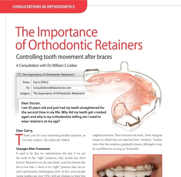 Importance Of Orthodontic Retainers Article at Charleston West Virginia