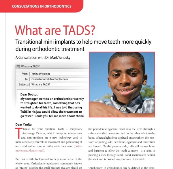 Temporary Anchorage Devices at Kalaskey Orthodontics Charleston West Virginia
