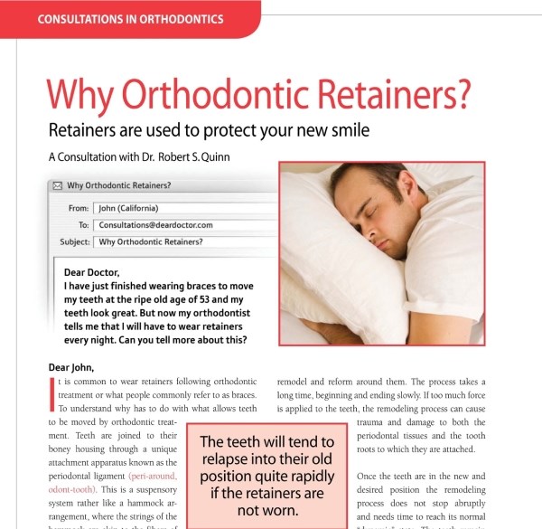 Why Orthodontic Retainers Article at Charleston West Virginia