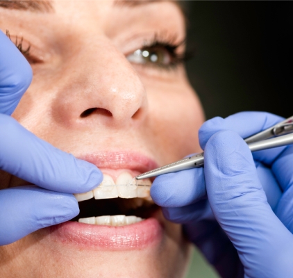 Doctor Performing A Teeth Cleaning at Charleston West Virginia